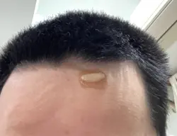 打噴嚏把頭撞破